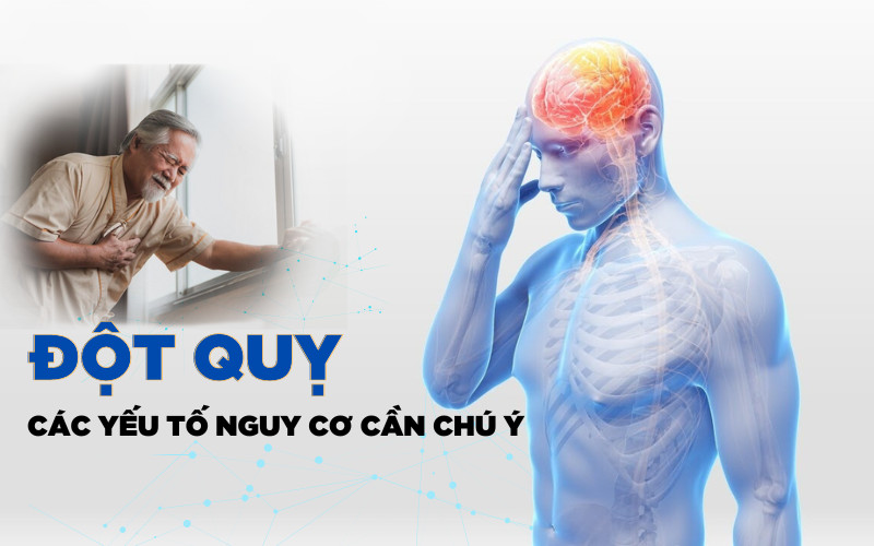 Tai biến mạch máu não và đột quỵ – Hiểm họa cần được quan tâm